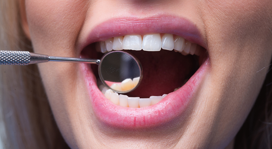 Why Cosmetic Dentistry Isn’t Just About Looks: Functional Benefits Explained