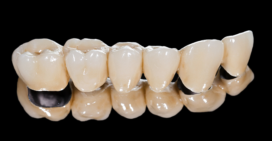 Restore Your Smile with Dental Bridges in Ashburn, VA