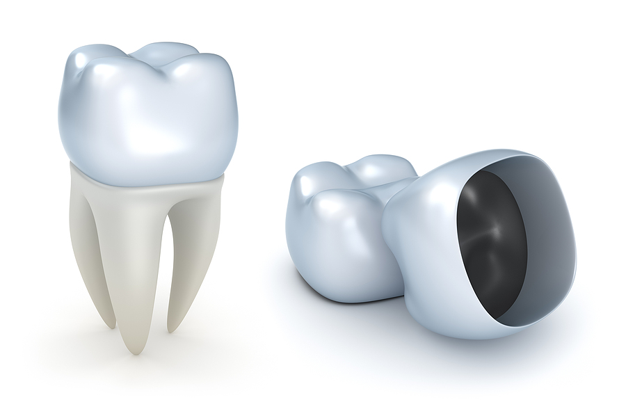 Restore Your Smile with Durable Dental Crowns in Ashburn, VA