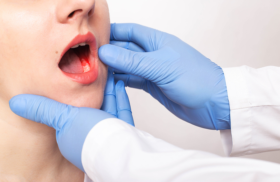 Restoring Oral Health: Comprehensive Gum Disease Treatment in Ashburn, VA